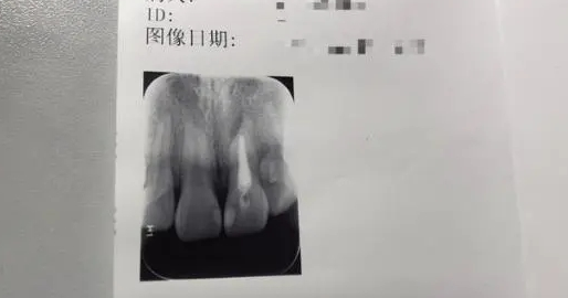 《抖音》脆皮大学生梗的来源及出处