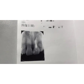 《抖音》脆皮大学生梗的来源及出处