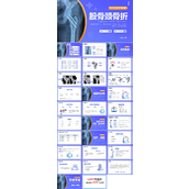 股骨颈骨医护人员培训讲座医学护理PPT
