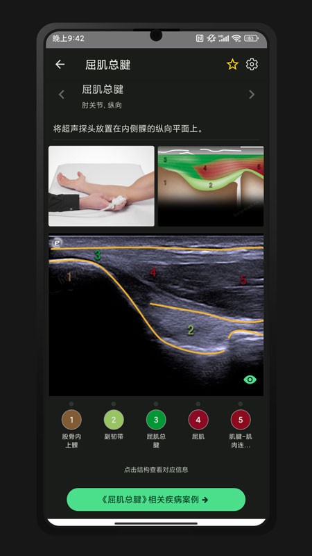 超声智学