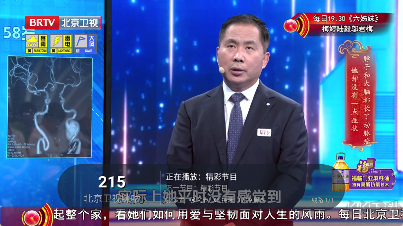 环边直播