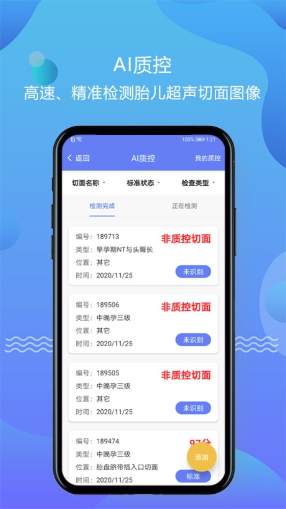 超声智库