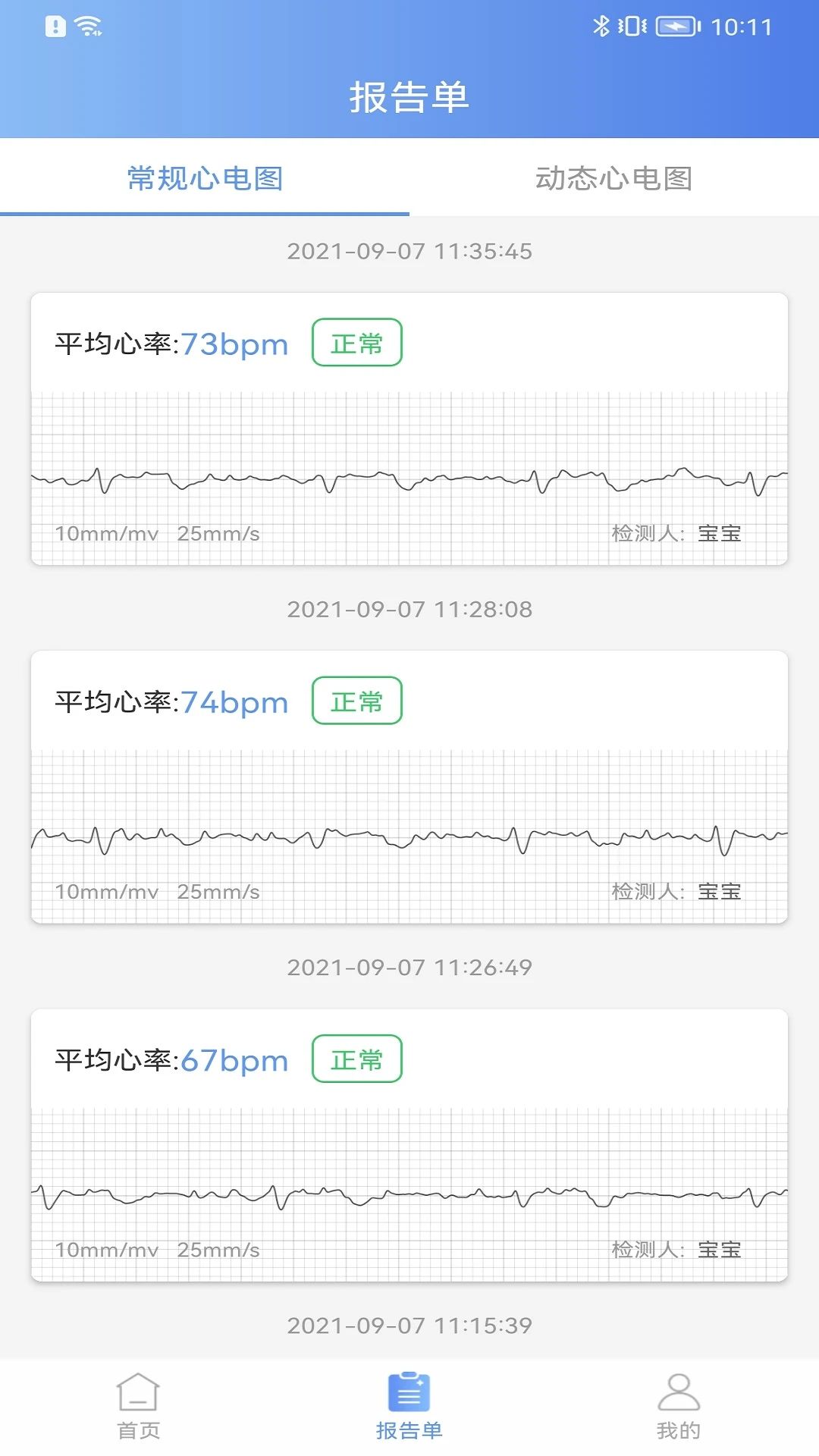 卡帕奇心电